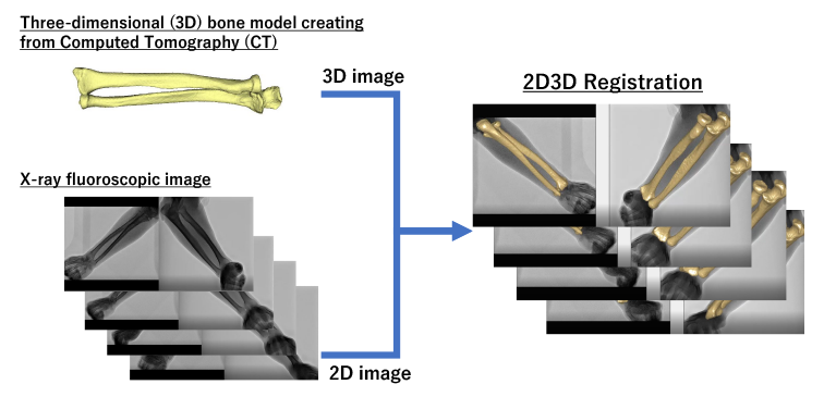 Reproduces detailed 3D motion of the upper limb