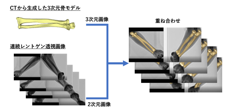 上肢の詳細な３次元動態を再現